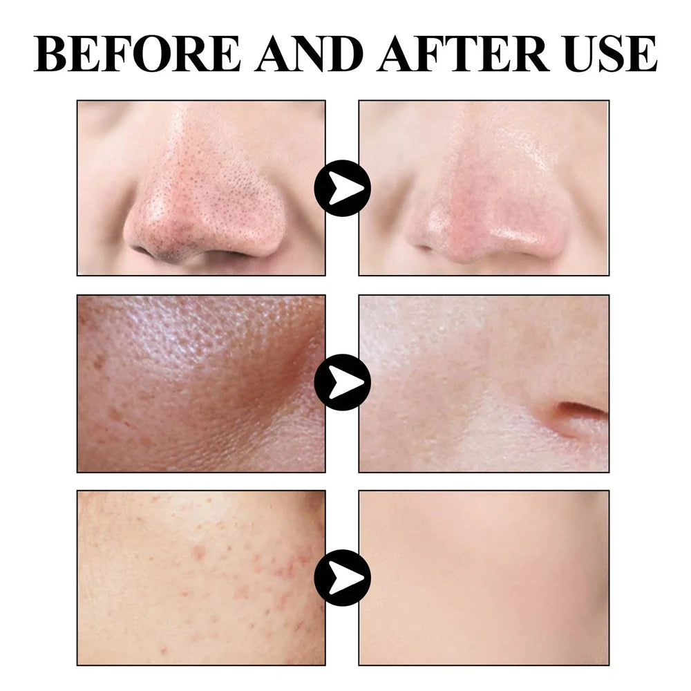 Blackhead Removal Mud Mask Oil Control Pore Refining Face Mask