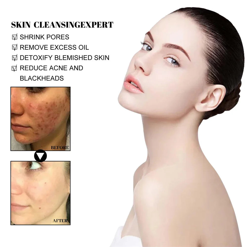 Blackhead Removal Mud Mask Oil Control Pore Refining Face Mask